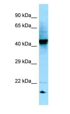 Polyclonal Rabbit anti-Human RGP1 Antibody (aa255-304, WB)