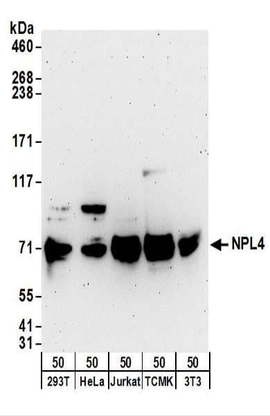Polyclonal Rabbit anti-Human NPLOC4 Antibody (aa75-125, WB)