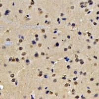 LMNB2 / Lamin B2 Antibody