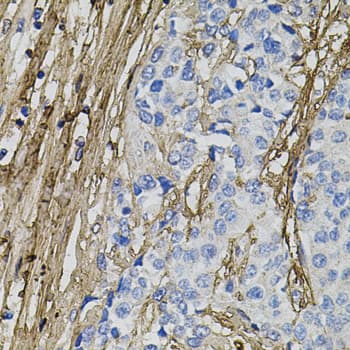 Polyclonal Rabbit anti-Human COL1A1 / Collagen I Alpha 1 Antibody (aa100-200, IHC, WB)