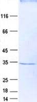 Human TRMT61A / TRM61 Protein (Recombinant His, N-Terminal)