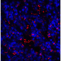 IHC-plus™ Polyclonal Rabbit anti-Human HAVCR2 / TIM-3 Antibody (IHC, IF, WB)