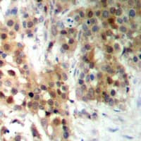 CAGE1 / Cancer Antigen 1 Antibody (C-Terminus)