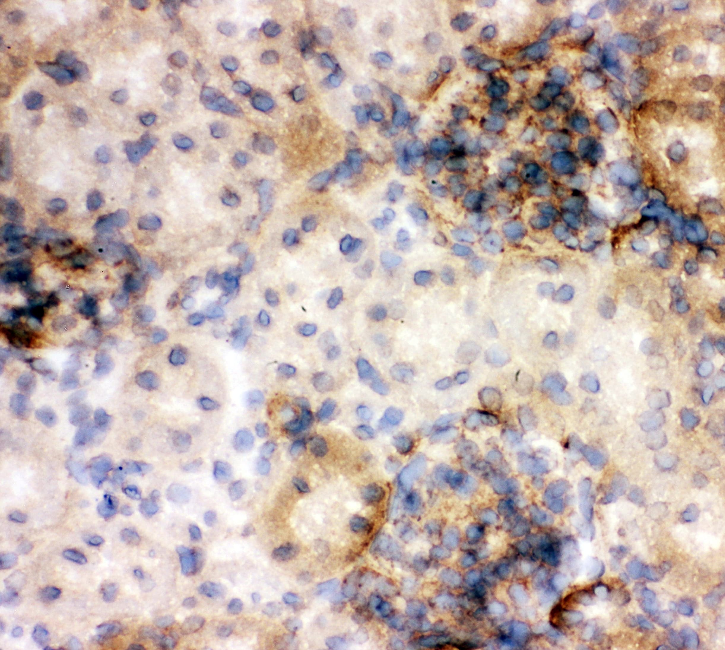 ANXA5 / Annexin V Antibody (aa2-320)