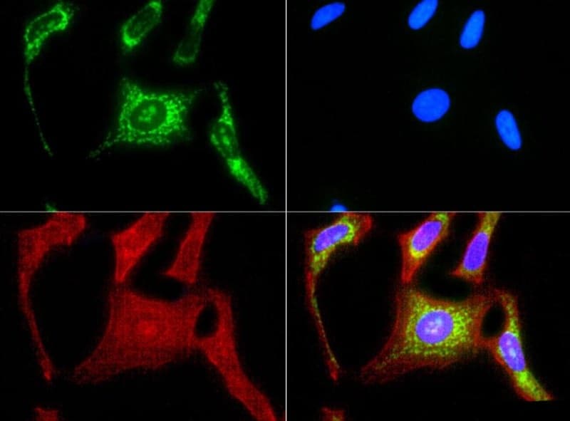 HSPD1 / HSP60 Antibody (Biotin)