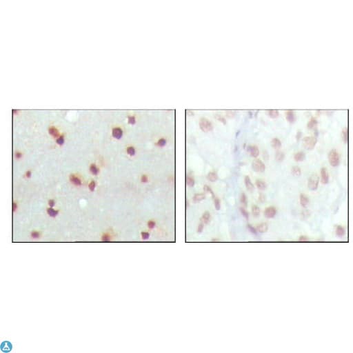 MDM4 / MDMX Antibody