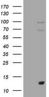 S100A1 / S100-A1 Antibody (clone OTI6G4)