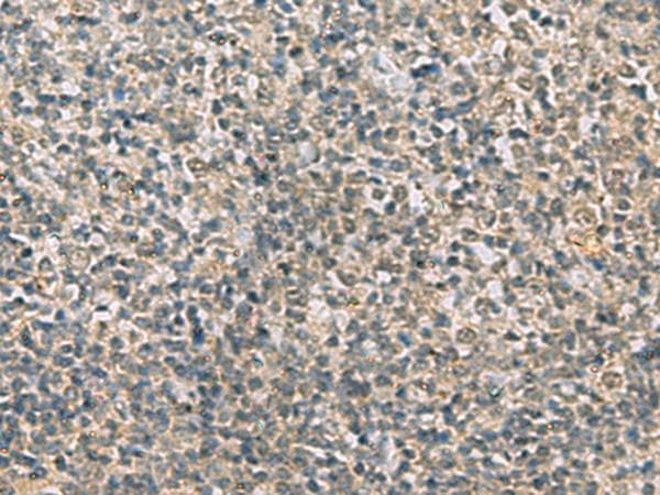 Polyclonal Rabbit anti-Human RAB3IP / RABIN3 Antibody (IHC)