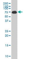 ALAS1 Antibody (clone 3G10)