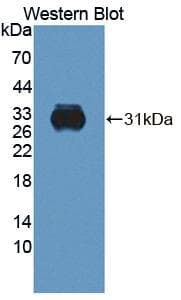 CELA2A / ELA2A Antibody (aa17-271, PE)