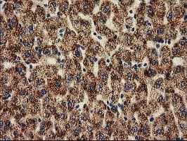 Monoclonal Mouse anti-Human HDAC6 Antibody (clone OTI1B3, IHC, IF, WB)