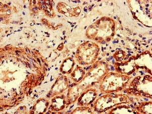 C1orf189 Antibody