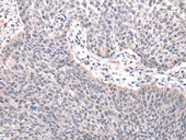 ZNF239 Antibody