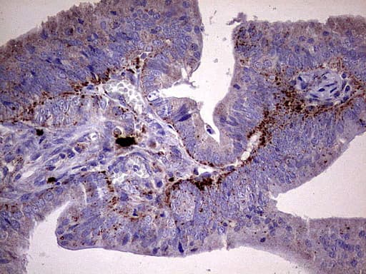 GBA / Glucosidase Beta Acid Antibody (aa40-315, clone UMAB171)