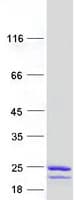 Human UBCH10 / UBE2C Protein (Recombinant Myc-DDK (Flag))