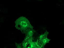 BAIAP2 / IRSP53 Antibody (clone OTI 1D9)