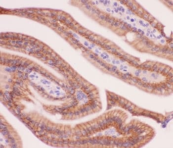 Alpha Catenin Antibody (aa143-292)