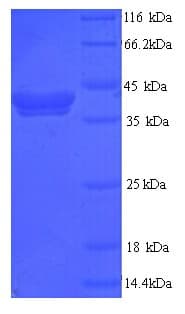 Human TPO / Thyroid Peroxidase Protein (Recombinant His)