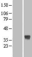 SFRP-3 / FRZB Protein (Over-Expression Lysate Myc-DDK (Flag))