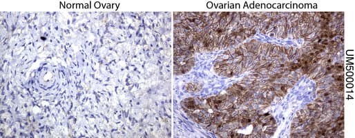CTNNB1 / Beta Catenin Antibody (clone UMAB14, Carrier-free)