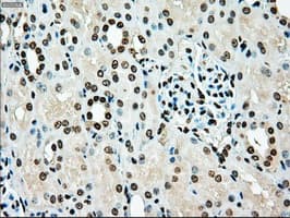 Monoclonal Mouse anti-Human TYRO3 Antibody (clone OTI2G2, IHC, WB)