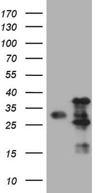 Monoclonal Mouse anti-Human VAP33 / VAPA Antibody (clone OTI1D3, aa2-227, WB)