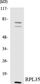 IHC-plus™ RPL35 / Ribosomal Protein L35 Antibody (aa42-91)
