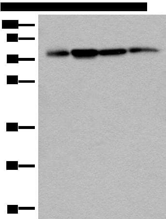 PHF21A / BHC80 Antibody