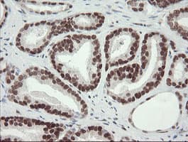 TLE1 / TLE 1 Antibody (clone OTI1D6)