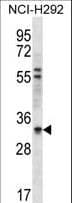 HAX-1 Antibody (aa161-190)