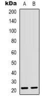 CD300LD Antibody (AA76-115)