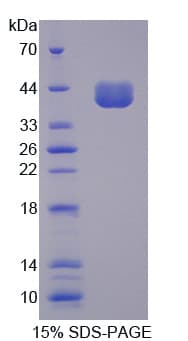 Pig CD14 Protein (Recombinant His)