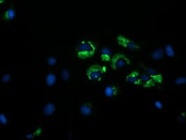 GORAB / SCYL1BP1 Antibody (clone OTI2E6)