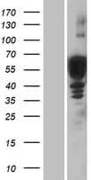 Human DCX / Doublecortin Protein (Over-Expression Lysate Myc-DDK (Flag))
