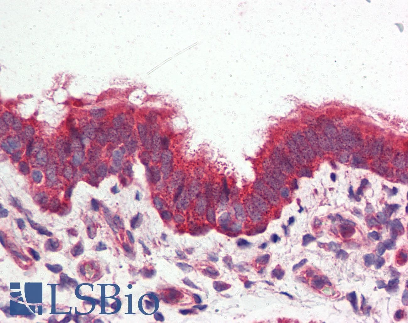 PathPlus™ Polyclonal Rabbit anti-Human GPRC6A Antibody (N-Terminus, IHC)
