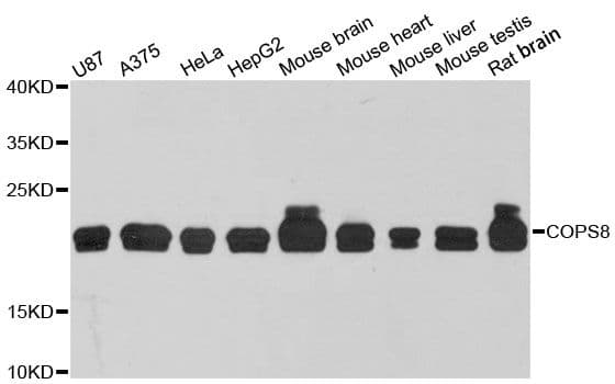 Polyclonal Rabbit anti-Human COPS8 / COP9 Antibody (WB)