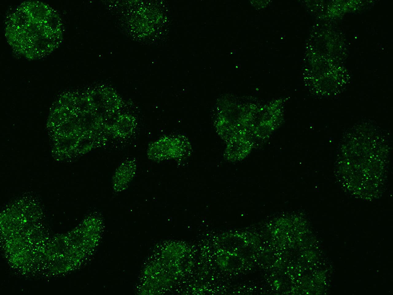 Polyclonal Rabbit anti-Human ALDP / ABCD1 Antibody (IHC, IF)