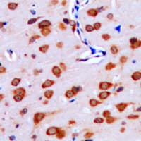 Polyclonal Rabbit anti-Human IPPK Antibody (N-Terminus, IHC, IF, WB)