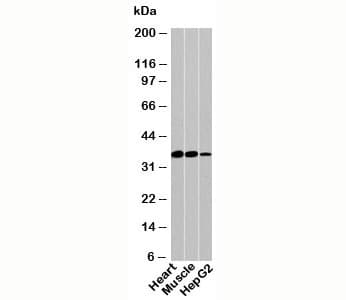 PDLIM1 Antibody
