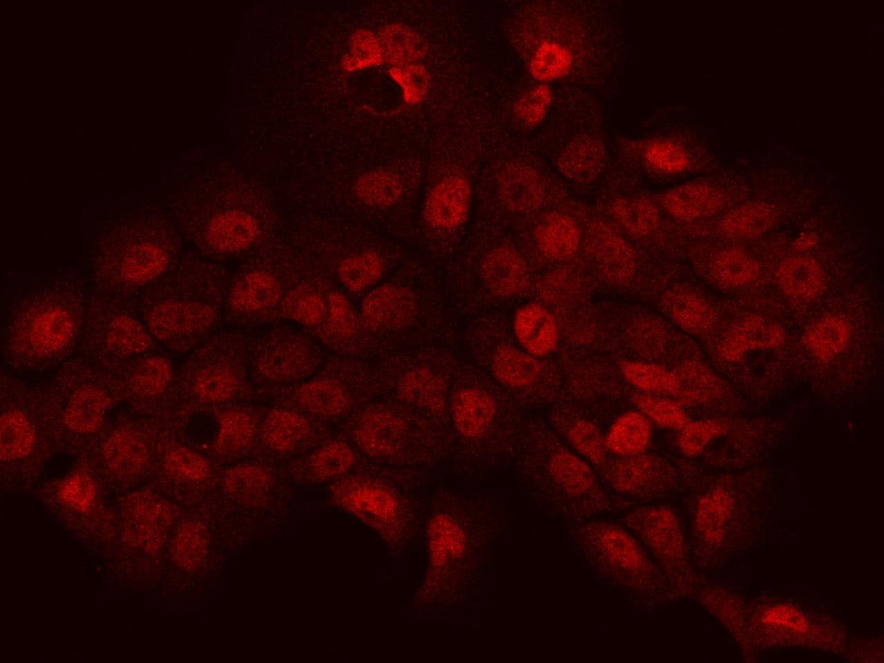 PHTF2 Antibody