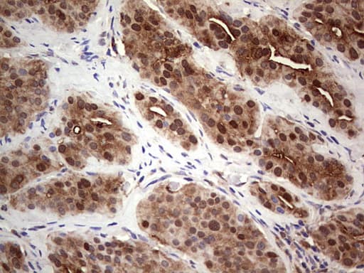Monoclonal Mouse anti-Human LGALS3 / Galectin 3 Antibody (clone OTI15E4, Carrier-free, IHC, WB)