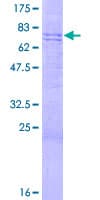Human DNAJA3 / TID1 Protein (Recombinant GST)