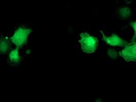 PNMT Antibody (clone OTI1D2, Carrier-free)