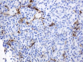 TP / Thymidine Phosphorylase Antibody (aa311-482, clone 7A6, Carrier-free)