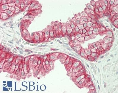 PathPlus™ CTNND1 / p120 Catenin Antibody (aa75-125)