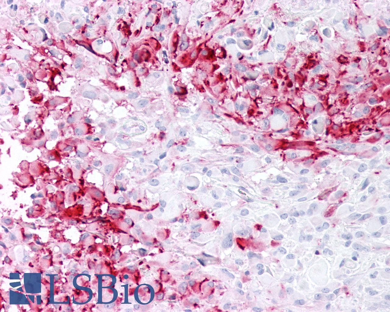 PathPlus™ MRGD / MRGPRD Antibody (Extracellular Domain)