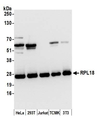 Polyclonal Rabbit anti-Human RPL18 / Ribosomal Protein L18 Antibody (aa138-188, WB)