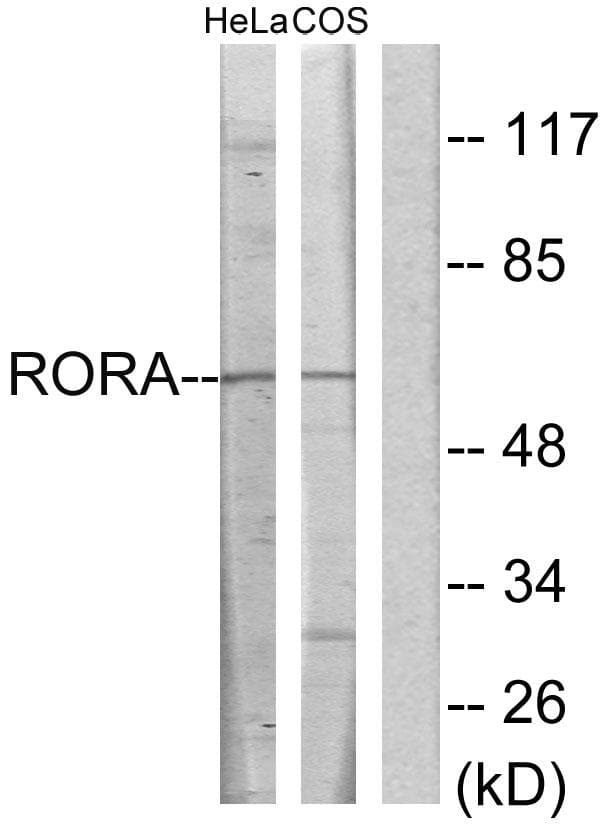 RORA / ROR Alpha Antibody