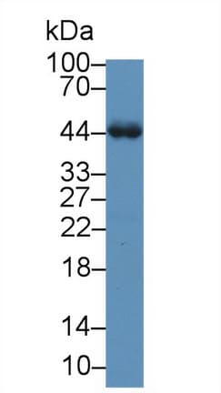 Polyclonal Rabbit anti-Rat ORM1 / Orosomucoid Antibody (aa19-201, WB)