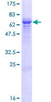Human TPBG / 5T4 Protein (Recombinant GST)